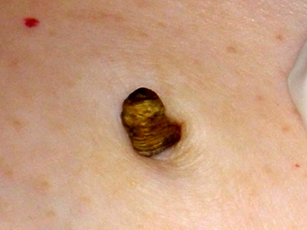   1 - 