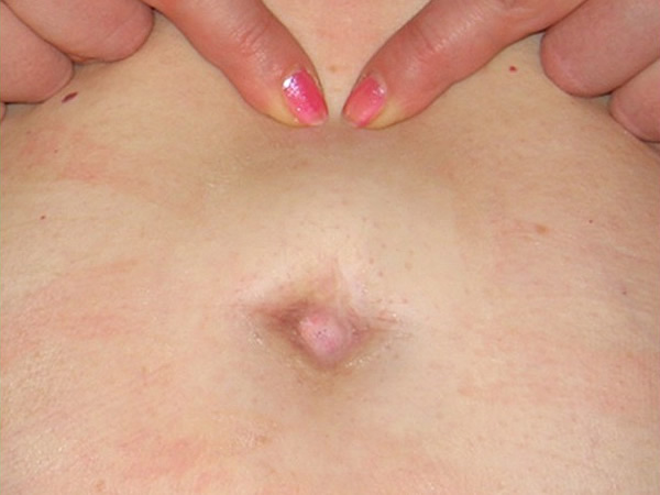   1 - 