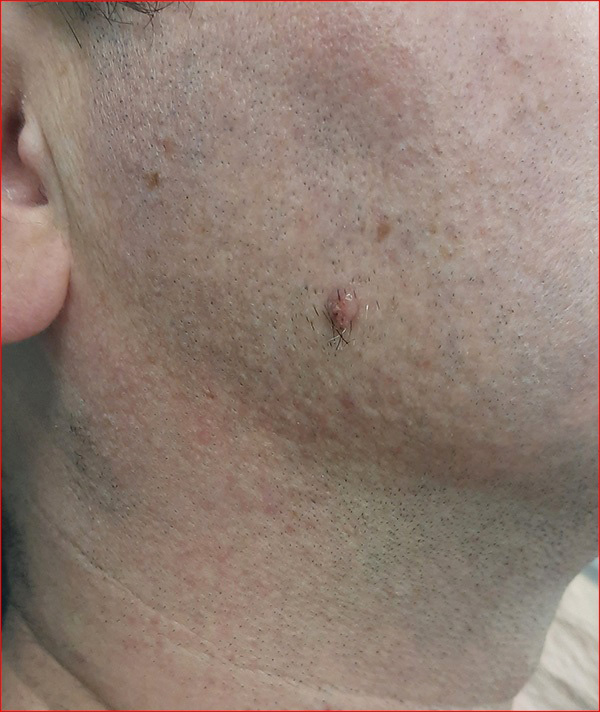  2 - 