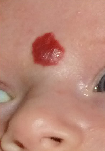  1 - 
