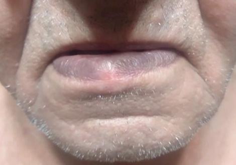  3 - 