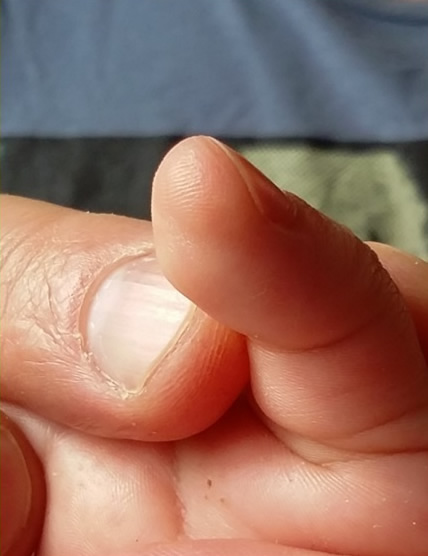  7 - 