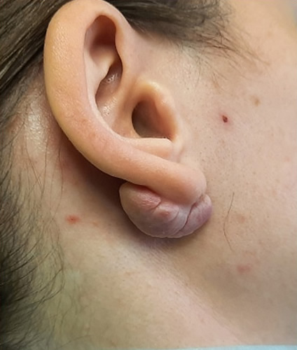   1 - 