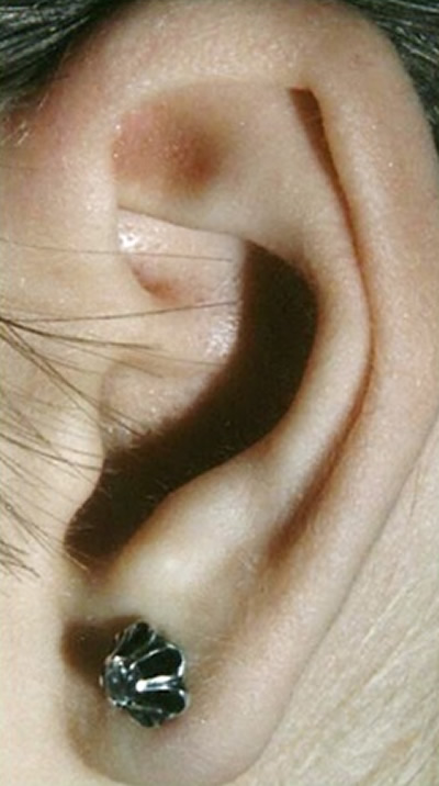  2 - 