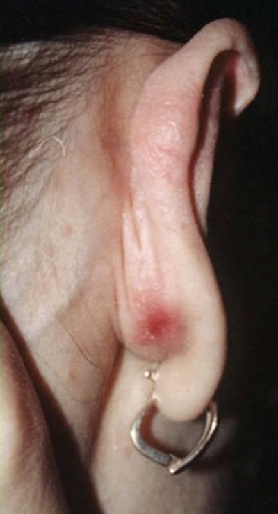   3 - 