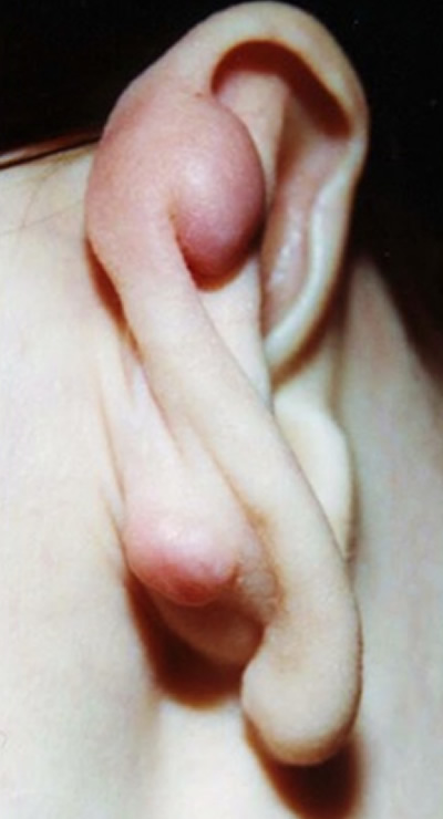   3 - 