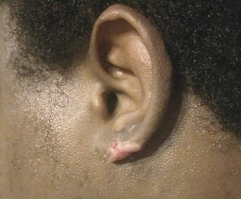   4 - 
