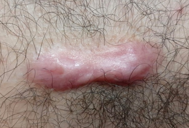   6 - 