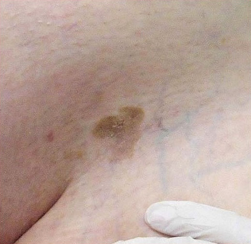  7 - 