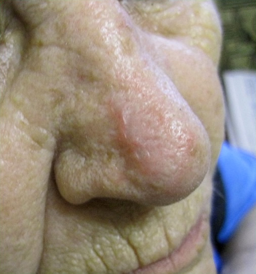  3 - 