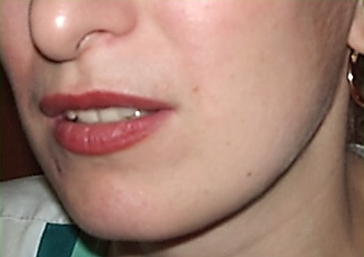  5 - 