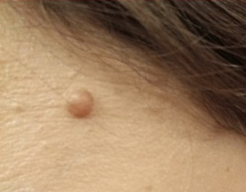  1 - 