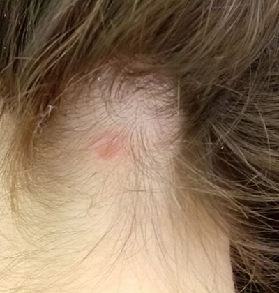  3 - 