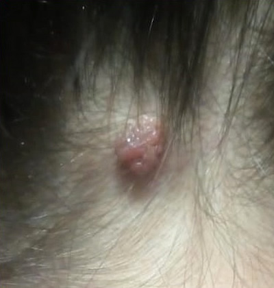  3 - 