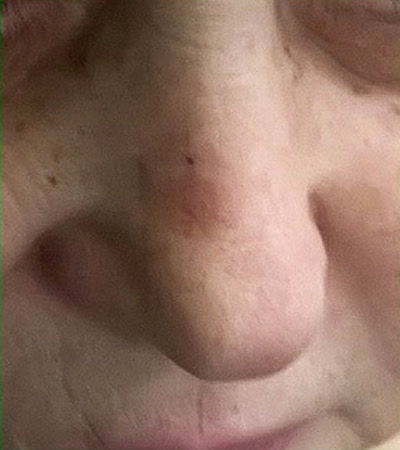  4 - 