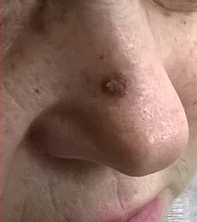  4 - 
