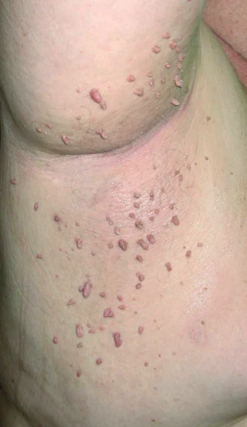  5 - 