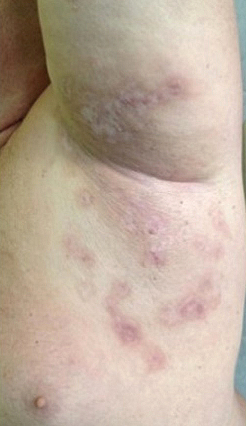  6 - 