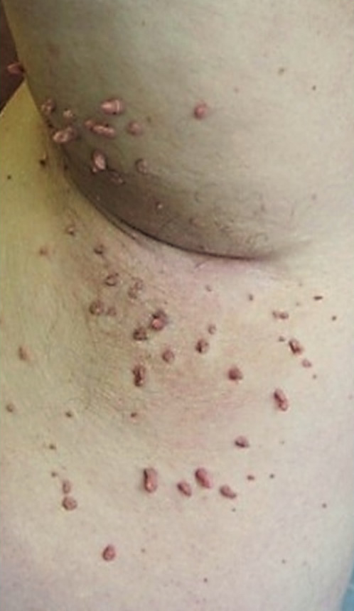  6 - 