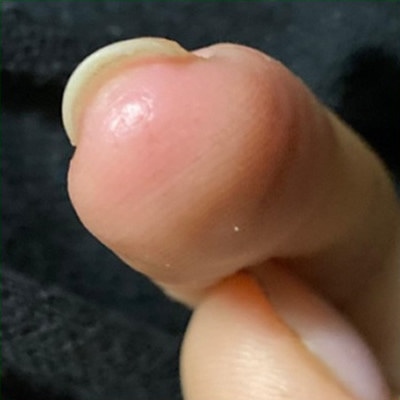  2 - 