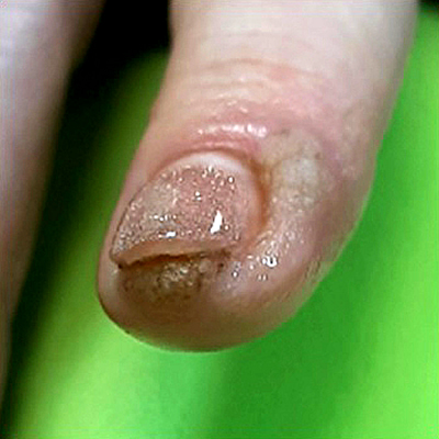  2 - 