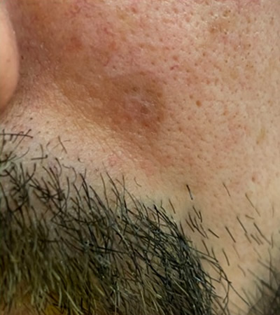 4 - 