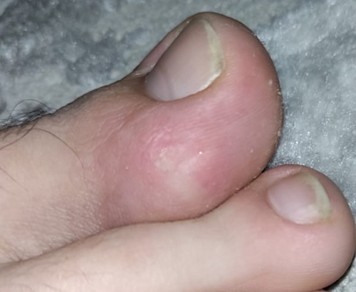  5 - 