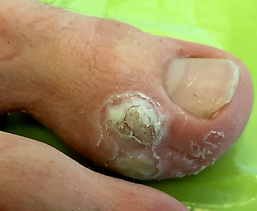  5 - 