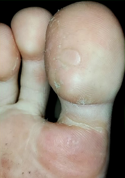  6 - 