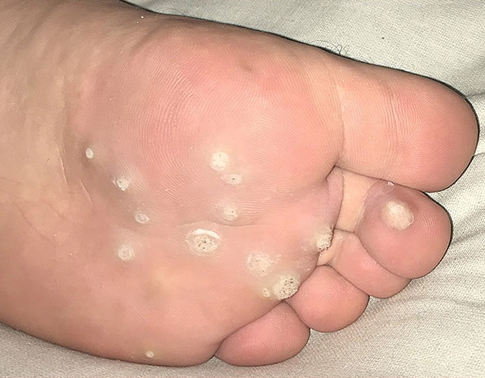  7 - 